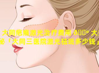 大同疤痕激光治疗费用 🐺 大揭秘「大同三医院激光祛斑多少钱」